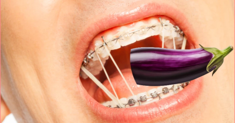 How to Suck Dick With Braces How to Suck Dick With Braces